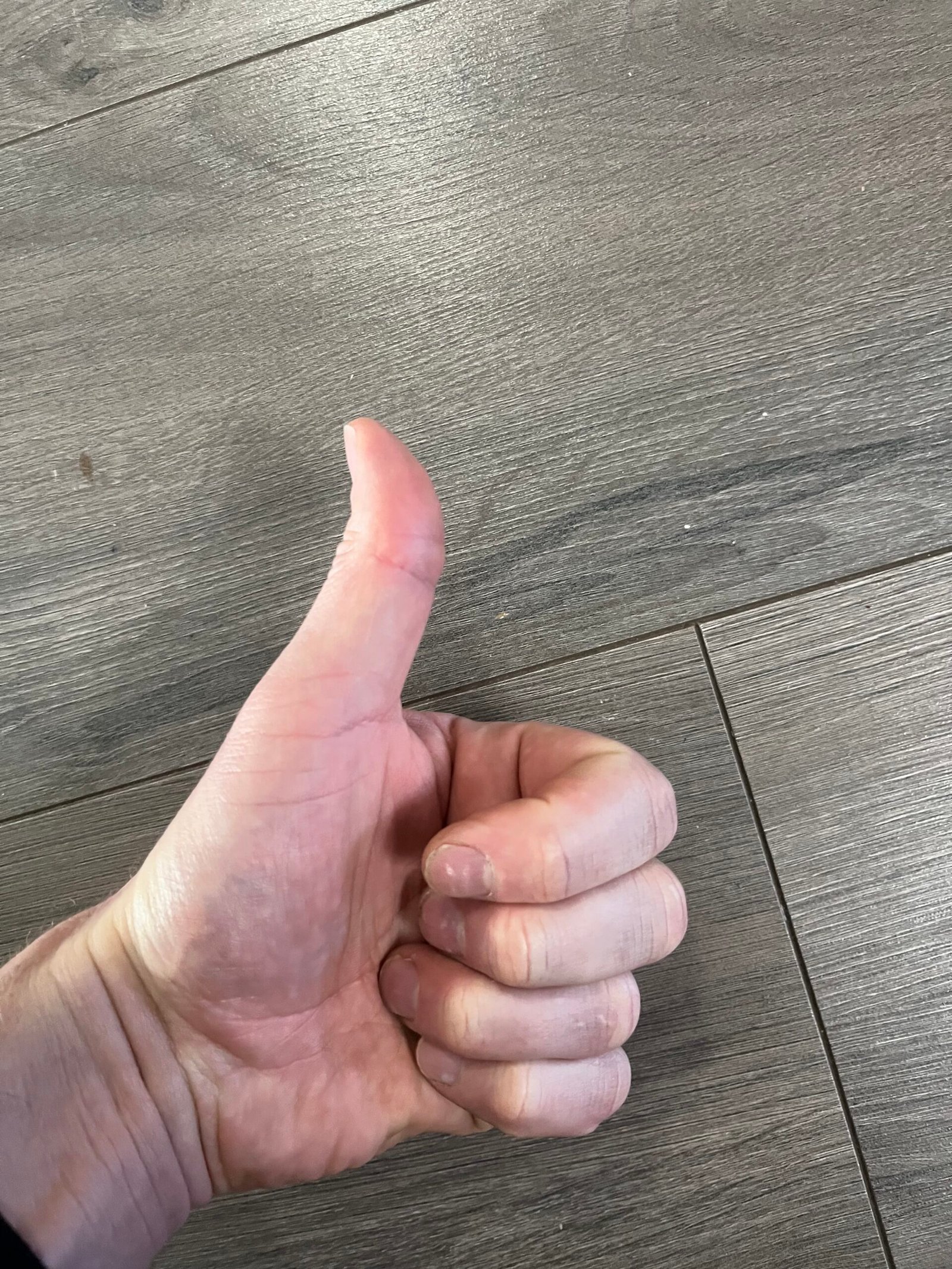 Thumbs up